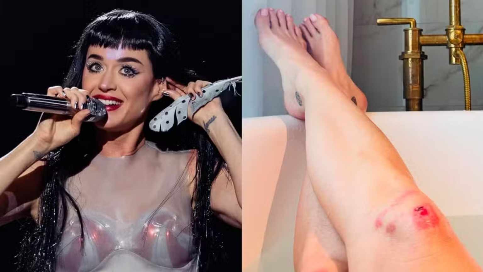 Katy Perry exibe joelhos machucados após fã desmaiar em seu palco