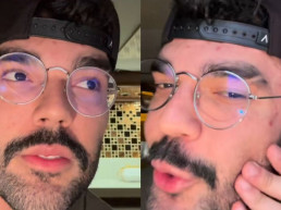 Luan Pereira quebra o silêncio sobre briga com Dado Dolabella: 'Tomei um empurrão'