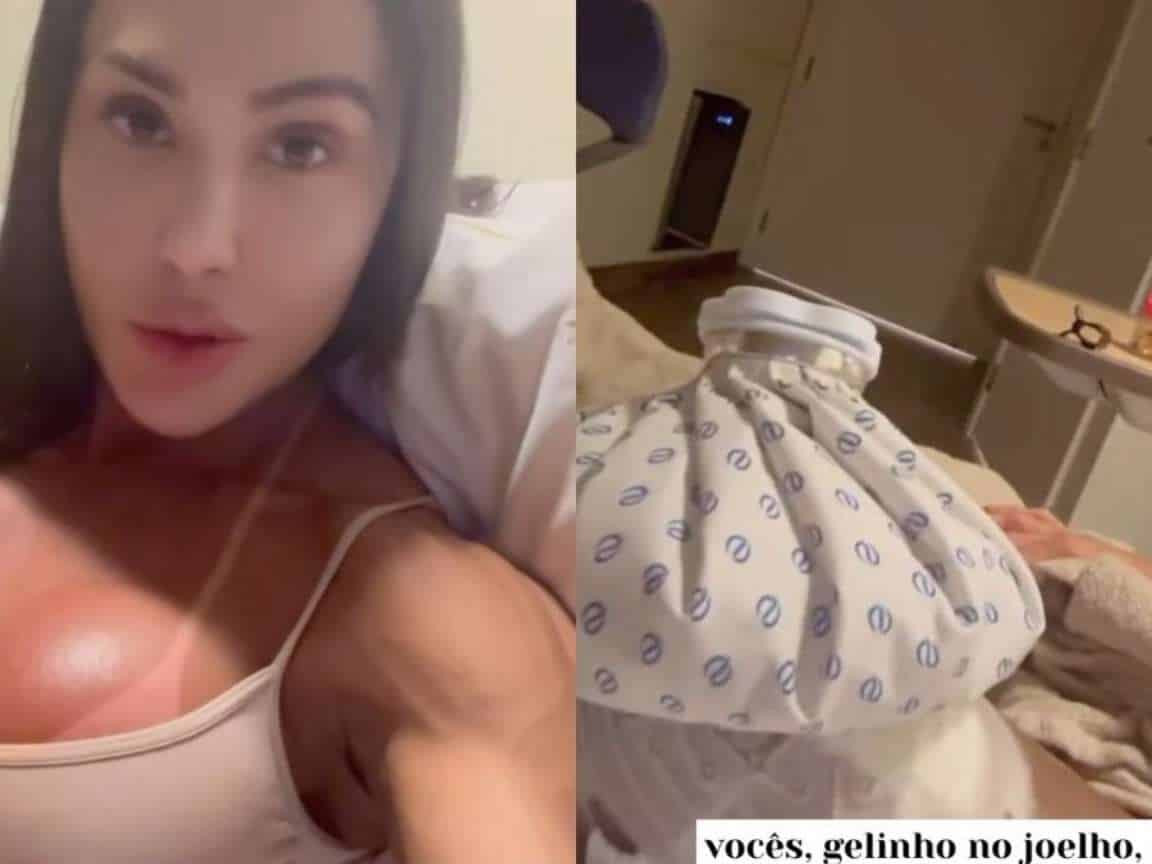 Gracyanne Barbosa atualiza estado de saúde após cirurgia: 'Super inchada'