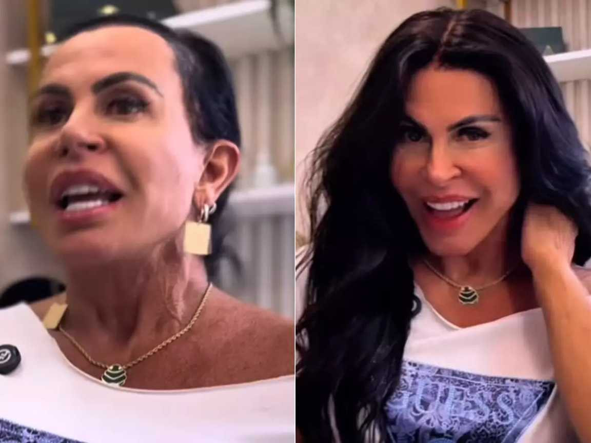 Gretchen revela luta contra alopecia e explica uso de perucas para autoestima