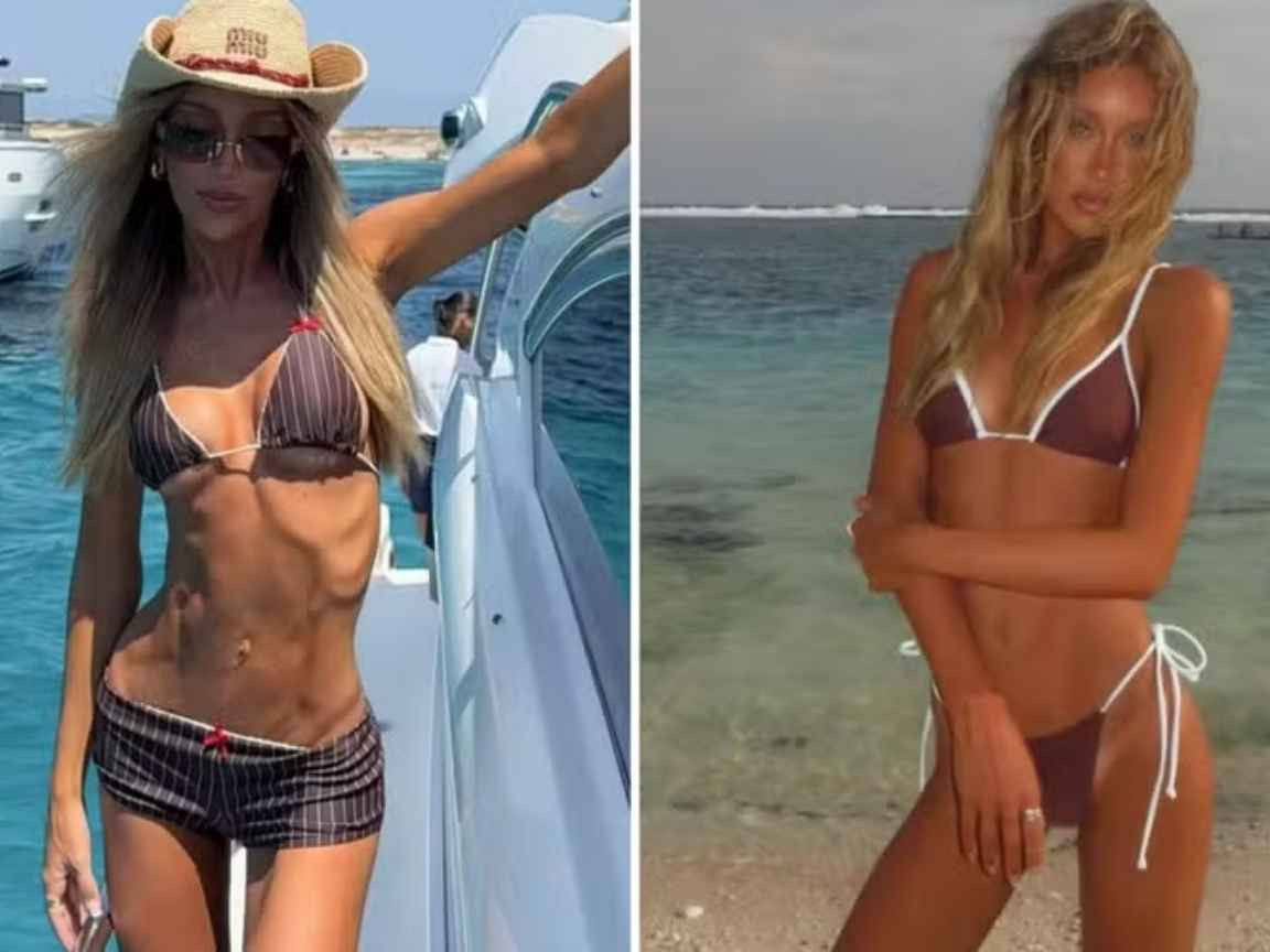 Influenciadora Sasha Morpeth preocupa fãs com fotos de corpo muito magro