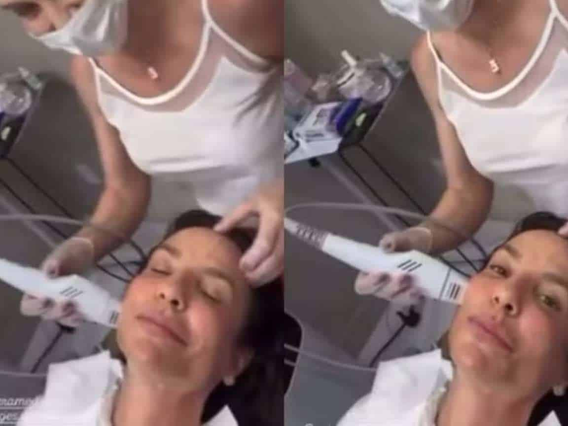 Ivete Sangalo adere a novo tratamento coreano para firmeza da pele; saiba mais