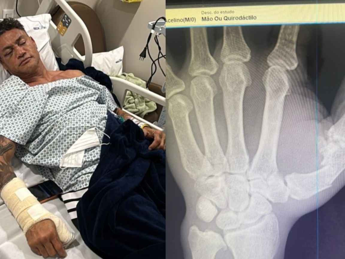 Popó é internado e passará por cirurgia após briga em luta com Wanderlei