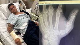 Popó é internado e passará por cirurgia após briga em luta com Wanderlei