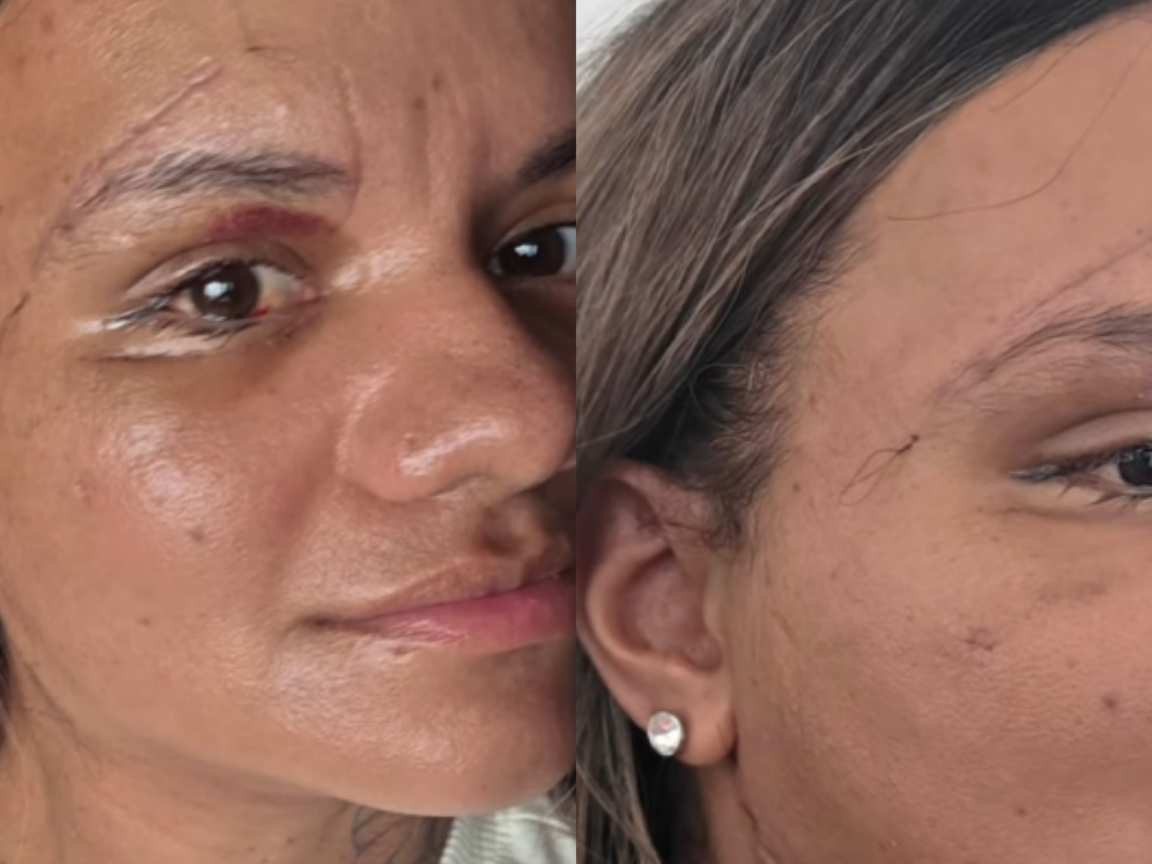 Agredida com 61 socos em elevador celebra: 'Grata por ter minha identidade de volta'