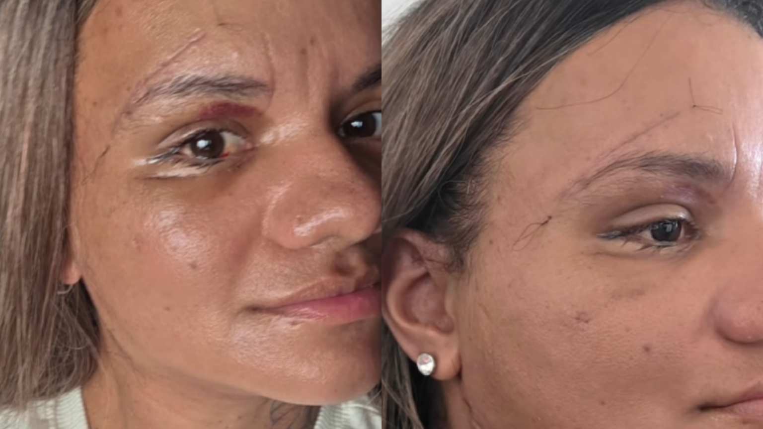 Agredida com 61 socos em elevador celebra: 'Grata por ter minha identidade de volta'