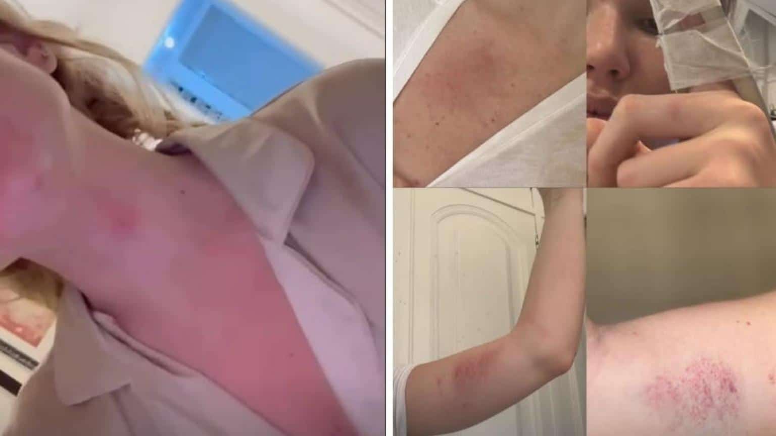 Ex de Dado Dolabella confirma agressão e diz que foi coagida a gravar vídeo negando