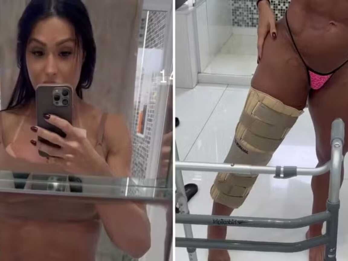 Gracyanne Barbosa mostra recuperação e desabafa: 'Zero preocupada com a estética'