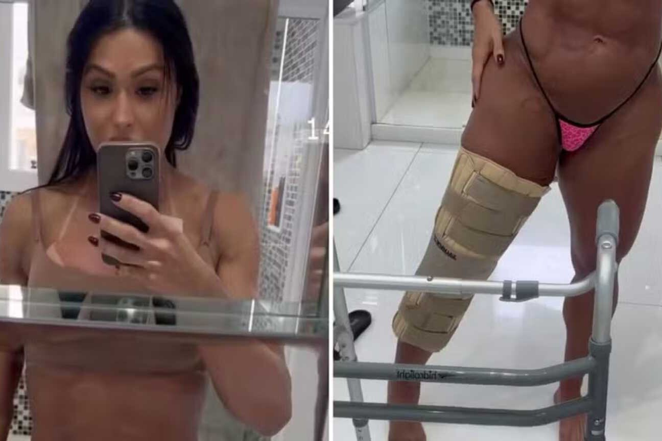 Gracyanne Barbosa mostra recuperação e desabafa: 'Zero preocupada com a estética'