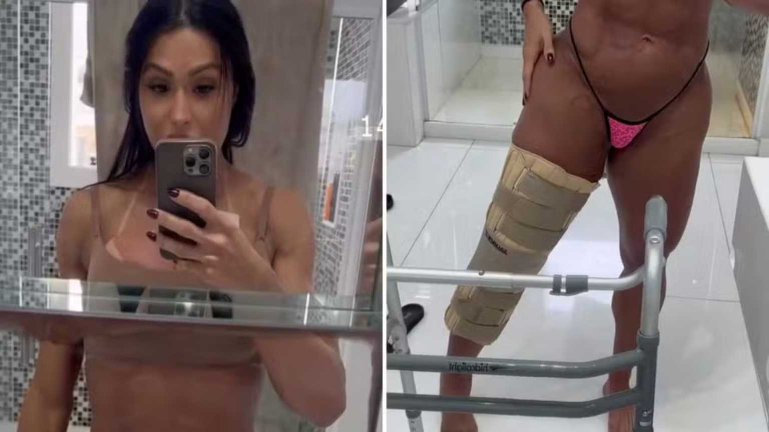Gracyanne Barbosa mostra recuperação e desabafa: 'Zero preocupada com a estética'