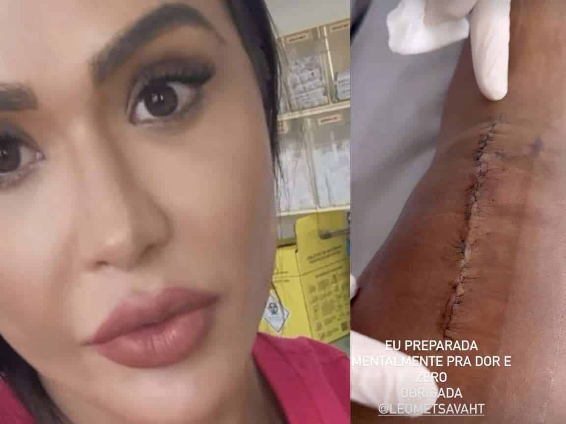 Gracyanne Barbosa mostra cicatriz de cirurgia e já volta aos treinos