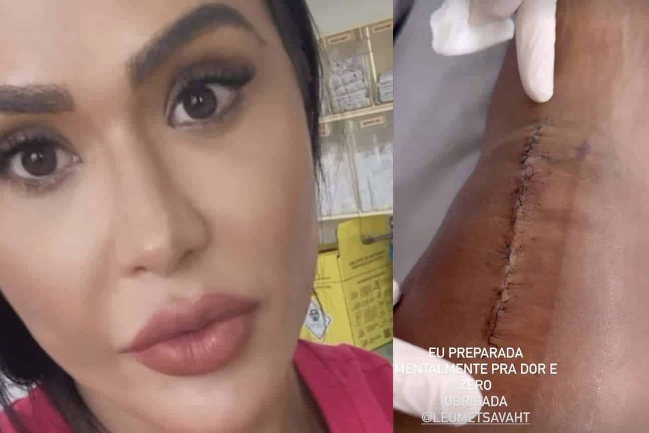 Gracyanne Barbosa mostra cicatriz de cirurgia e já volta aos treinos