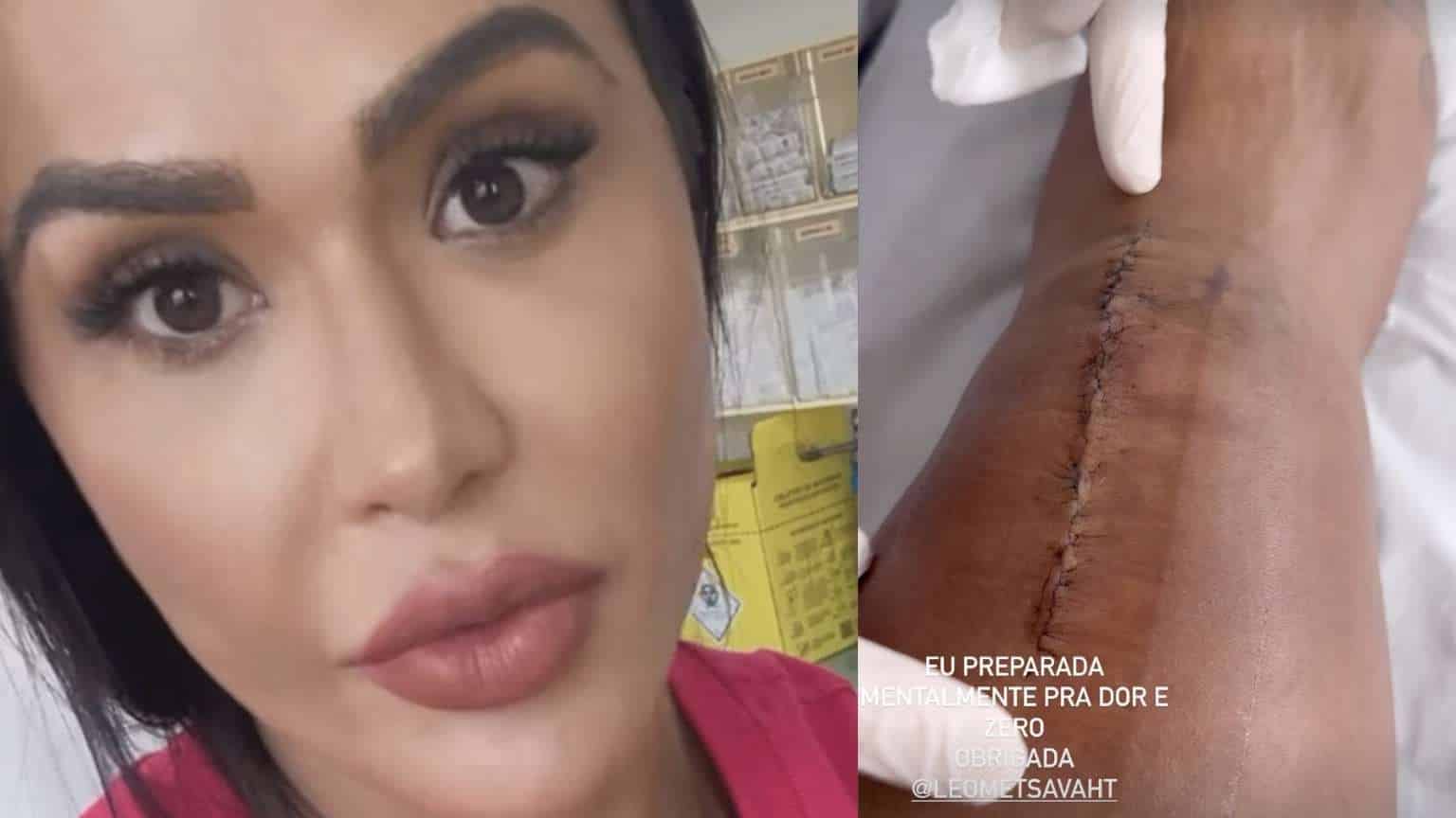 Gracyanne Barbosa mostra cicatriz de cirurgia e já volta aos treinos