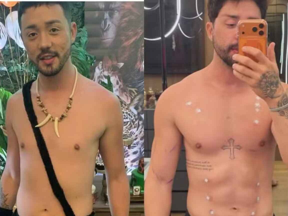 Rico Melquiades faz 15º procedimento estético e rebate críticas: 'Sou 100% cirurgia'