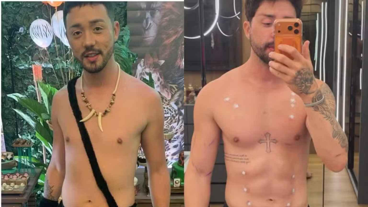 Rico Melquiades faz 15º procedimento estético e rebate críticas: 'Sou 100% cirurgia'